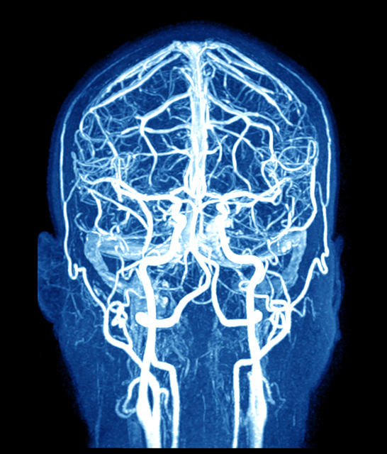 Risonanza magnetica dell'encefalo e dei vasi cerebrali