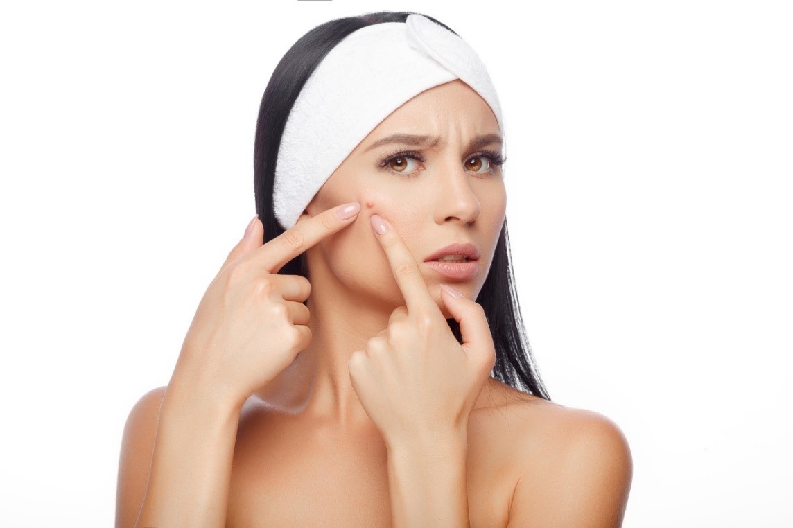 Una donna si sta ammalando di acne, il che è inopportuno.