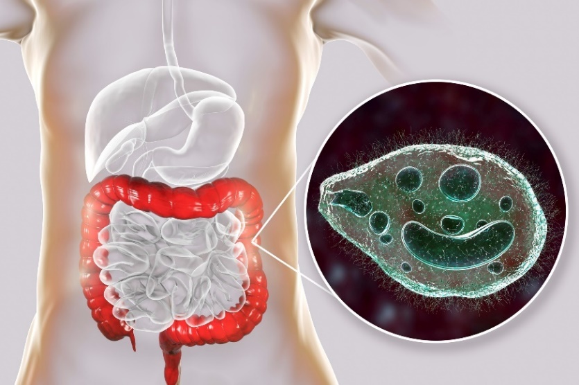 Balantidium coli - parassita che infetta l'intestino crasso dell'apparato digerente umano.