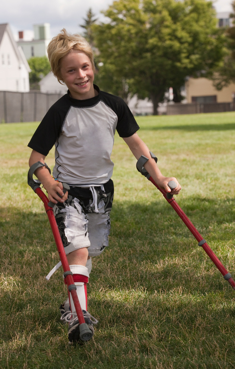 Un bambino con paralisi cerebrale e una protesi per camminare. 