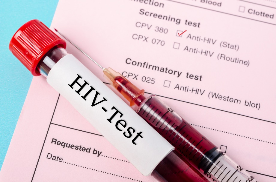 Test diagnostico per la presenza di anticorpi anti-HIV in un campione di sangue del paziente