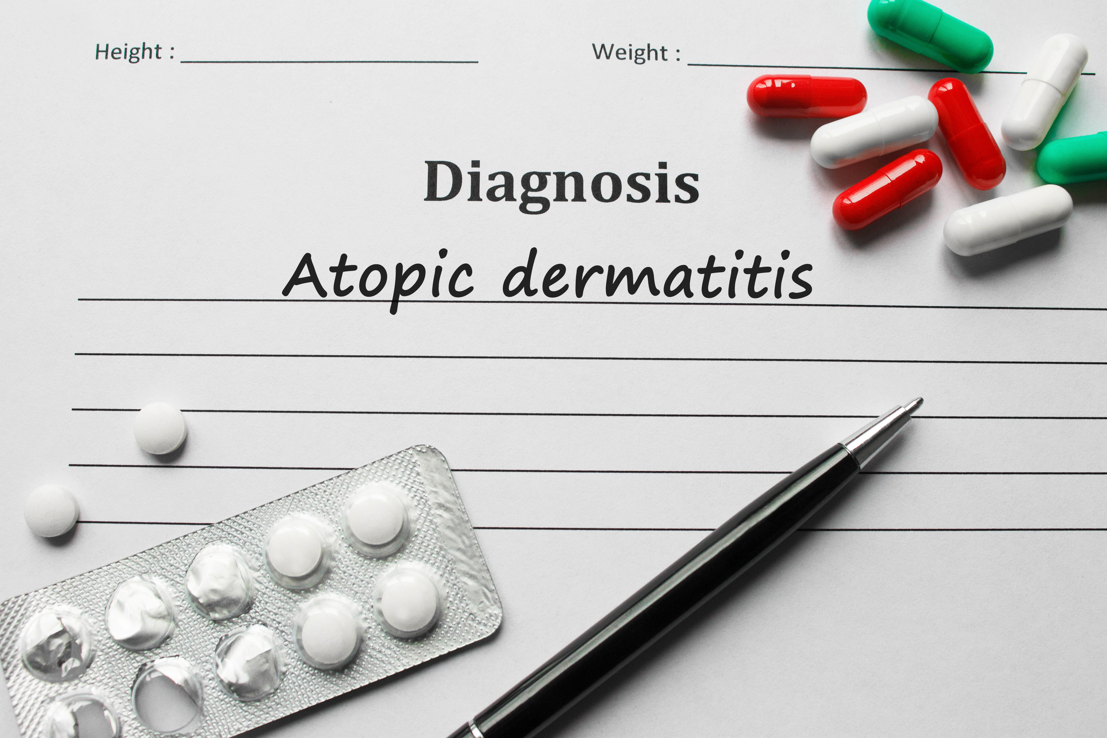 Diagnosi di dermatite atopica