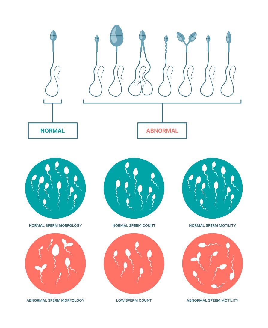 Condizioni fisiologiche e anormali degli spermatozoi. Morfologia, numero e motilità degli spermatozoi.