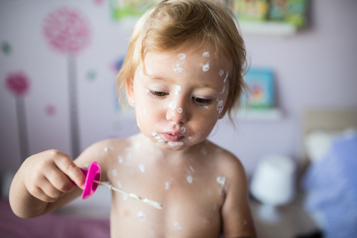 Una bambina con un lieve caso di varicella gioca con un soffiatore di bolle di sapone