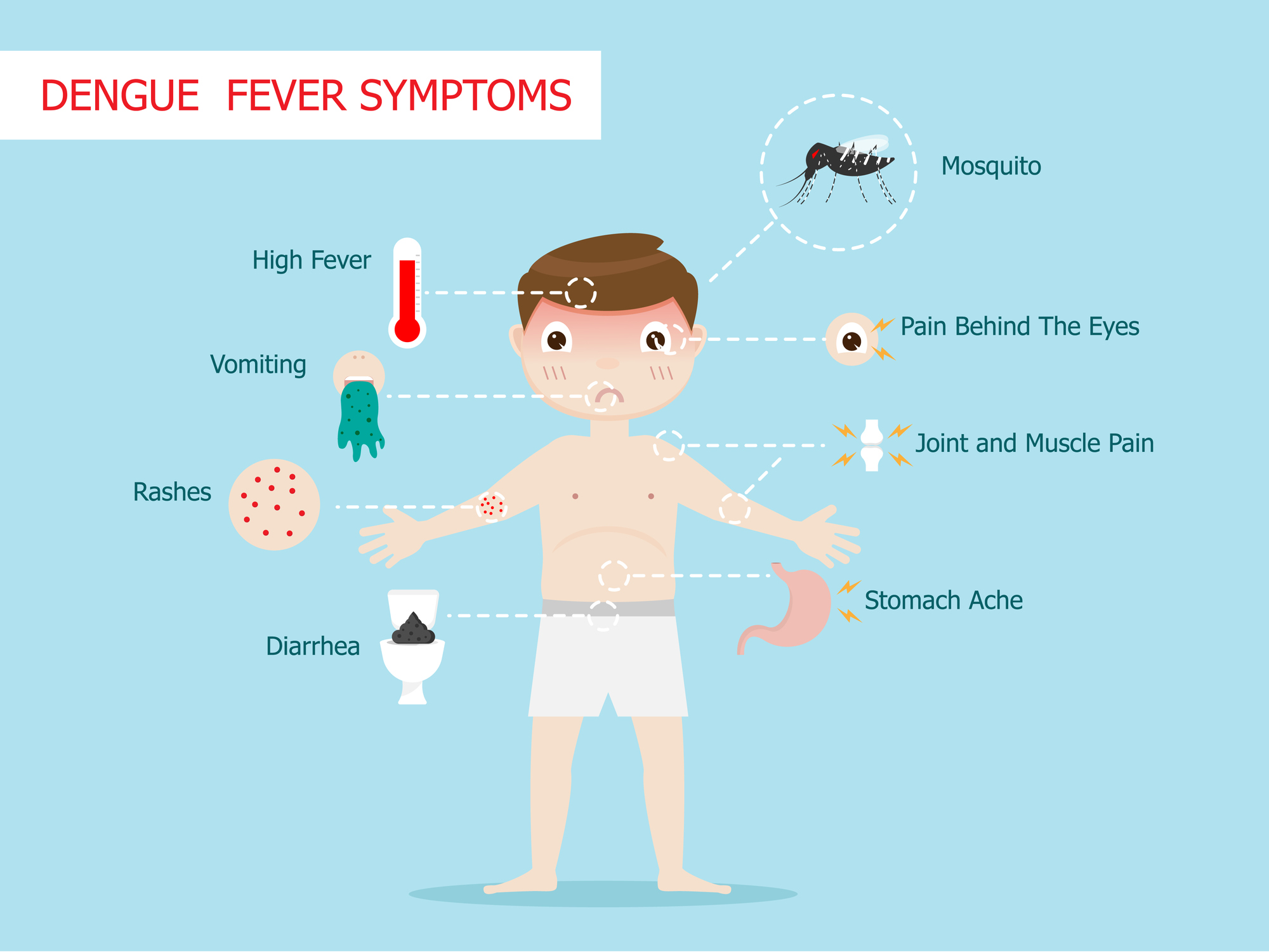 Sintomi della febbre dengue