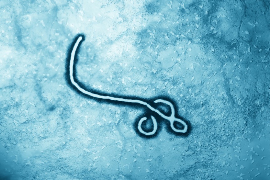 Il virus Ebola al microscopio