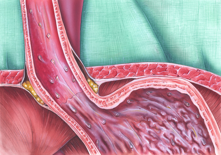 sfintere dell'esofago anatomicamente rappresentato