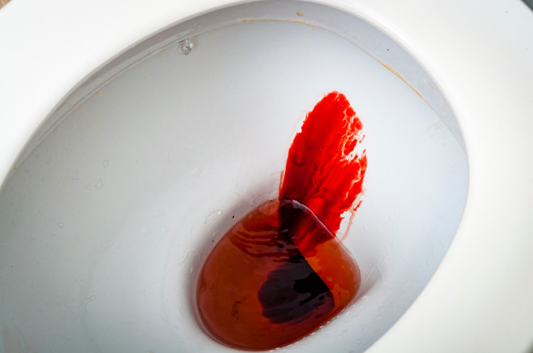 sangue fresco nella tazza del water bianco