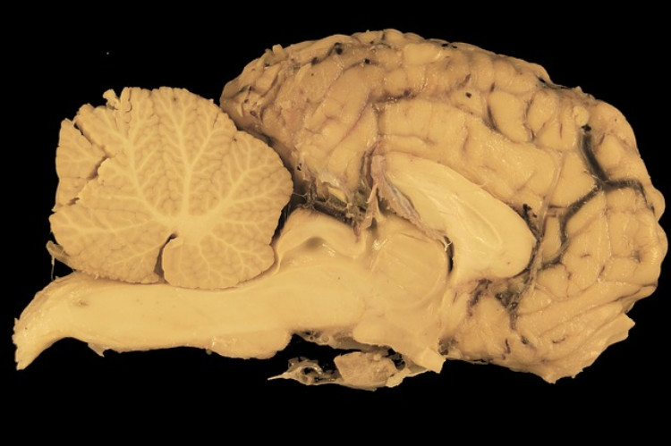 sezione trasversale di tessuto cerebrale