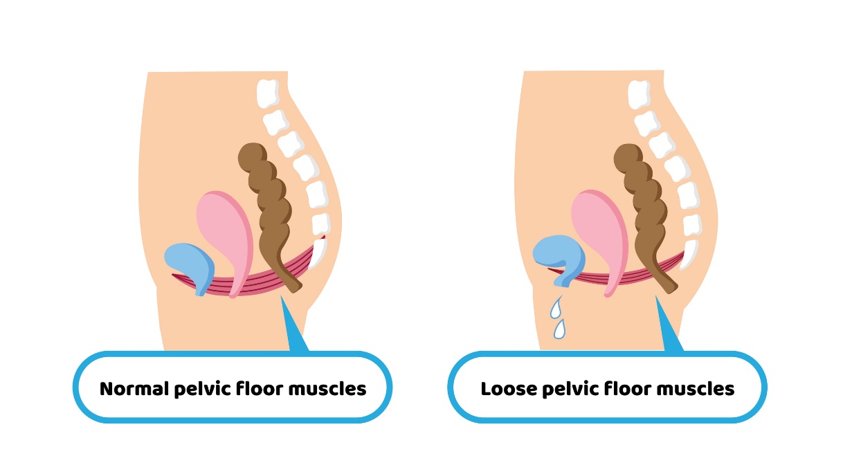 Fisiologia della muscolatura del pavimento pelvico e debolezza della muscolatura del pavimento pelvico