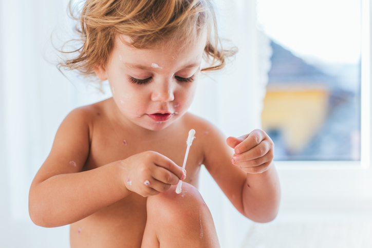 Una bambina nuda si tratta la pelle con un tampone di cotone