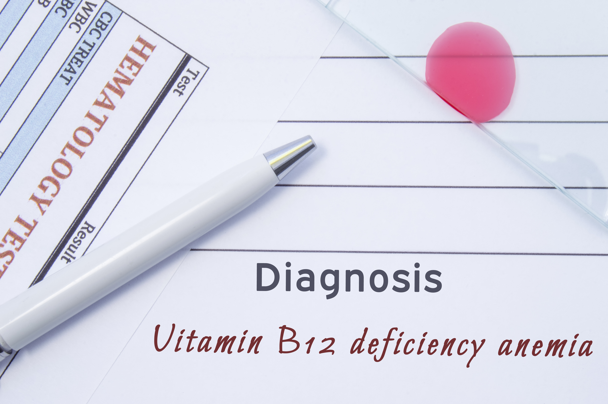 La carenza di vitamina B12 può causare anemia perniciosa.