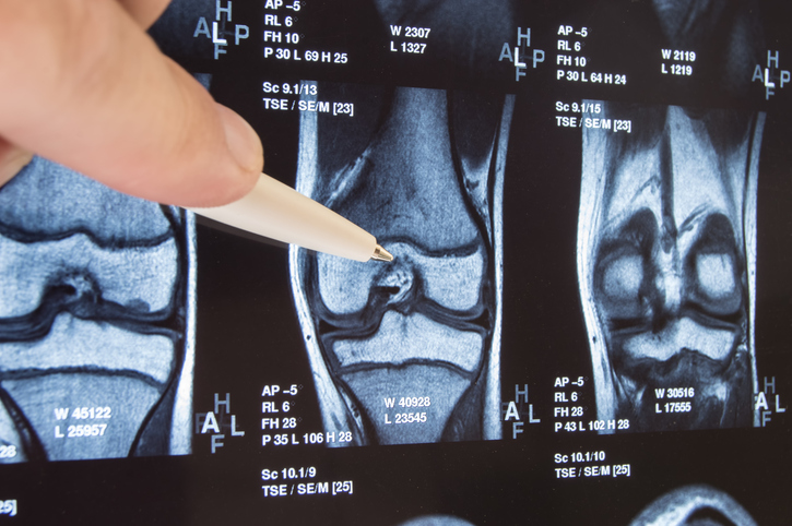 Radiografia con articolazione