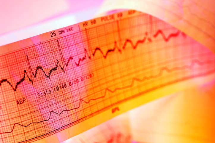 Registrazione ECG