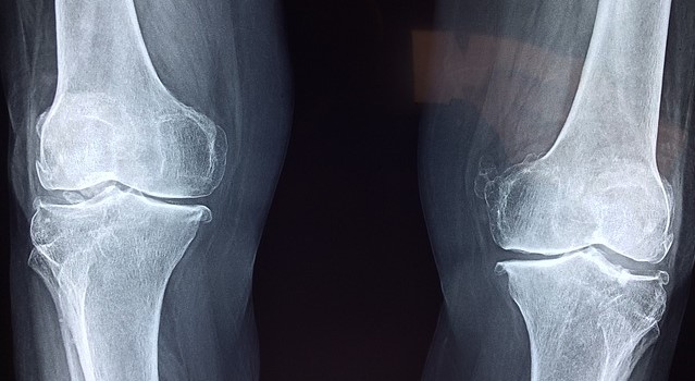 Radiografia delle articolazioni del ginocchio