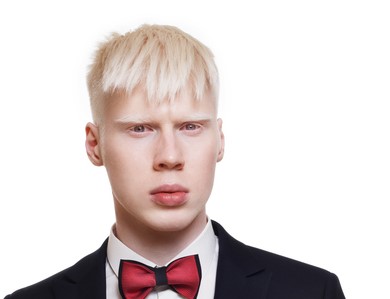 giovane maschio albino, capelli bianchi, indossa una giacca