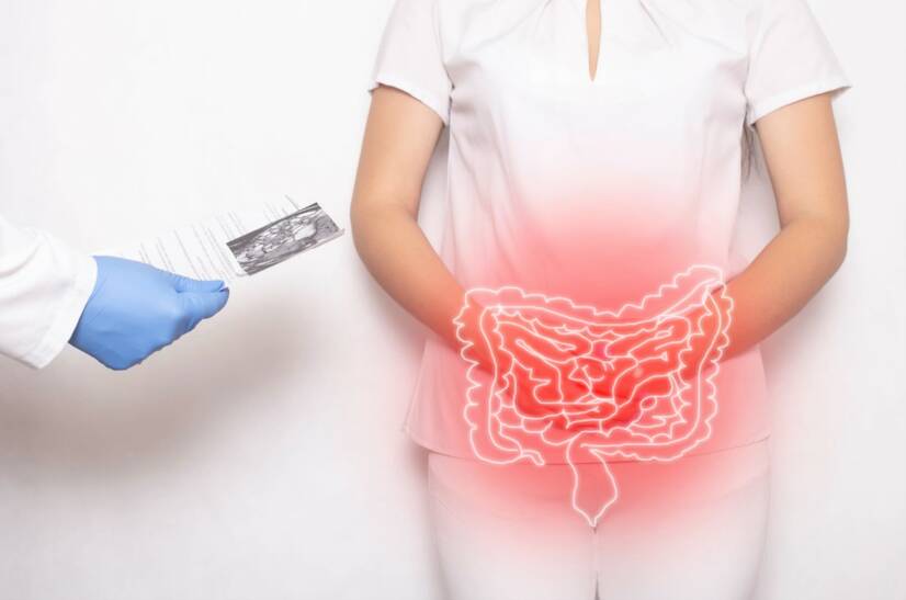 La malattia di Crohn: cos'è, perché si manifesta e quali sono i sintomi?