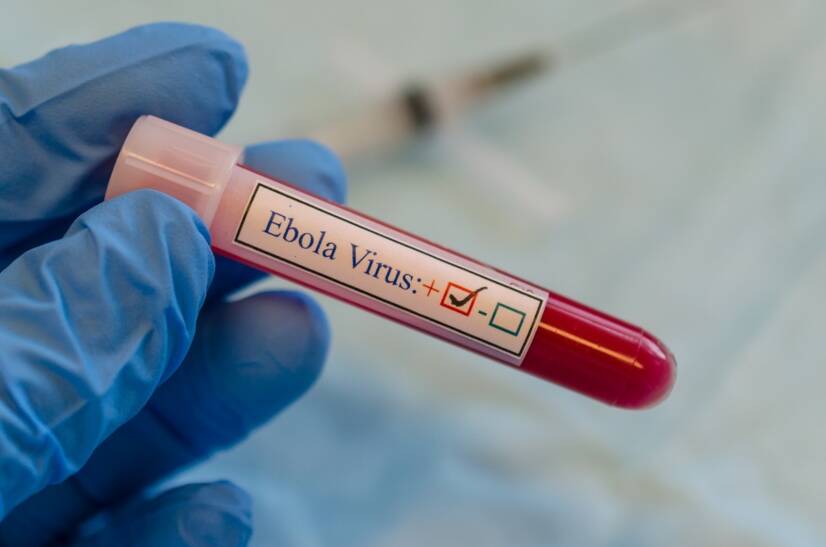 Ebola: quali sono i sintomi?