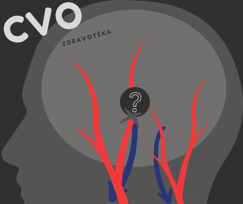 Malattia cerebrovascolare: vasi sanguigni cerebrali indeboliti, ristretti o dilatati? Conoscere le cause e i sintomi