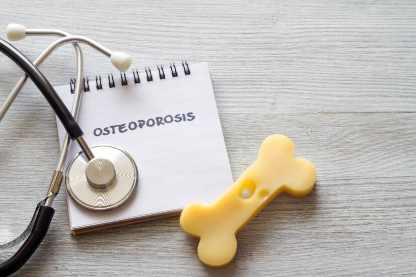 OSTEOPOROSI: quando le ossa si indeboliscono e il trattamento è difficile. Quali sono le cause, i sintomi e le conseguenze + consigli per la prevenzione?