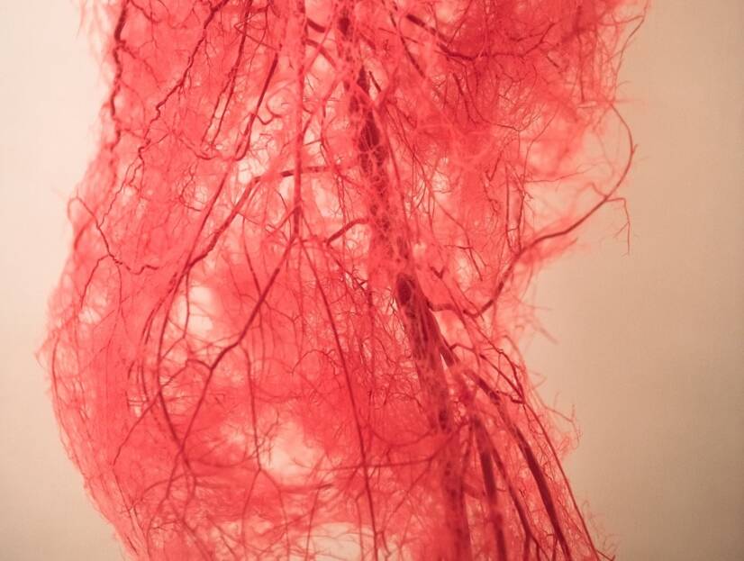 Arteriopatia periferica: quali sono le cause e i sintomi + Prevenzione e trattamento