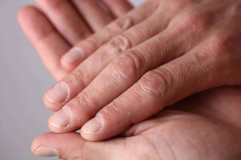 Come prendersi cura delle mani? 3 fasi: lavaggio, disinfezione, crema