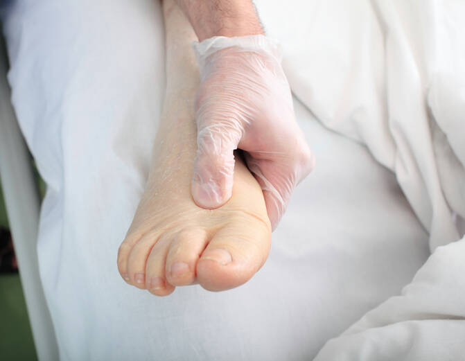 Gonfiore (edema) degli arti: quali sono le cause del gonfiore di mani, piedi e caviglie?