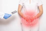 La malattia di Crohn: cos'è, perché si manifesta e quali sono i sintomi?