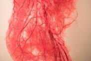 Arteriopatia periferica: quali sono le cause e i sintomi + Prevenzione e trattamento